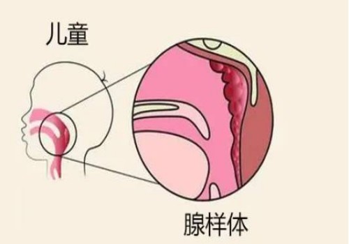 二胎時間間隔多久性別有差異，附生二胎注意事項